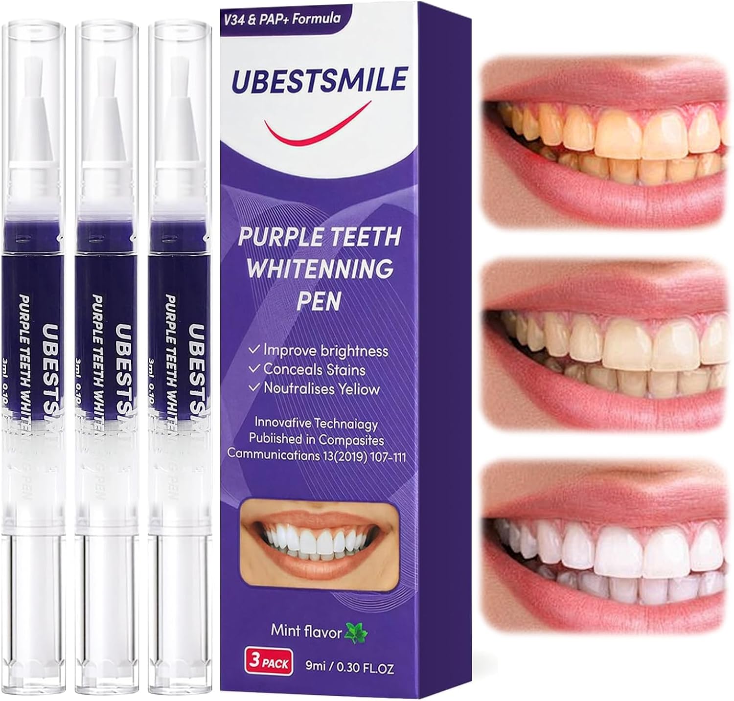 قلم تبييض الأسنان الأرجواني UB - مراجعة Teeth Whitening Pens وسعره