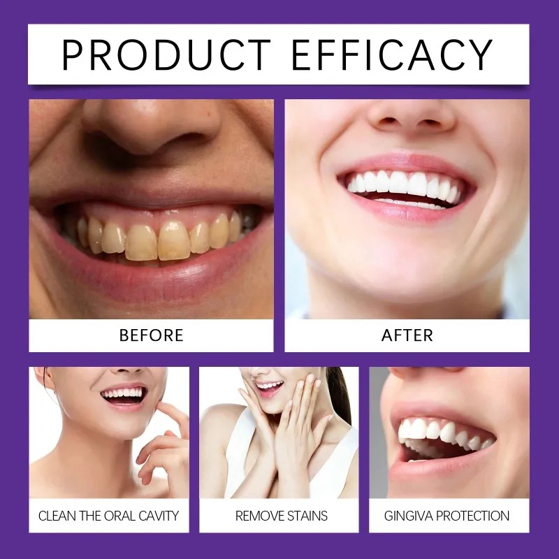 مسحوق معدني لتلميع الأسنان بال - مراجعة Teeth Whitening Near Me وسعره